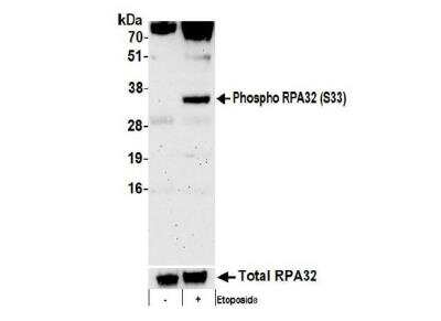 Western Blot: RPA2 [p Ser33] Antibody [NB100-544]